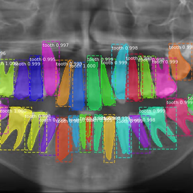 Teeth Segmentation